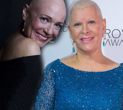 Carla Andrino e Jó Caneças: amigas com cancro apoiam-se uma à outra