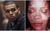 Chris Brown relata agressão a Rihanna: