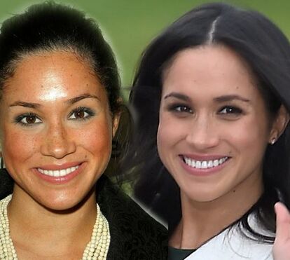 Apanhada! Meghan Markle já fez plásticas para melhorar a imagem