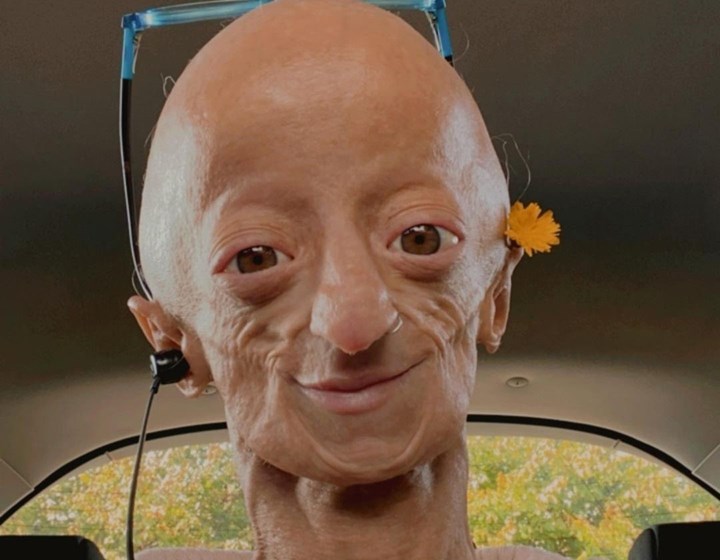 Cl Udia Amaral A Portuguesa Que Faleceu Aos Anos Devido Progeria