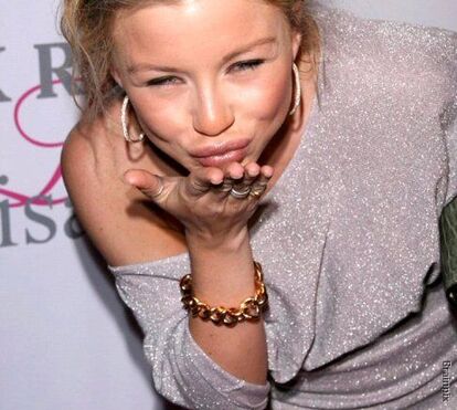 Casey Johnson morreu por falta de insulina