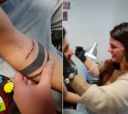 Antes e depois. 'Antes da operação era uma pessoa infeliz e uma mulher sem auto-estima!', diz Fanny