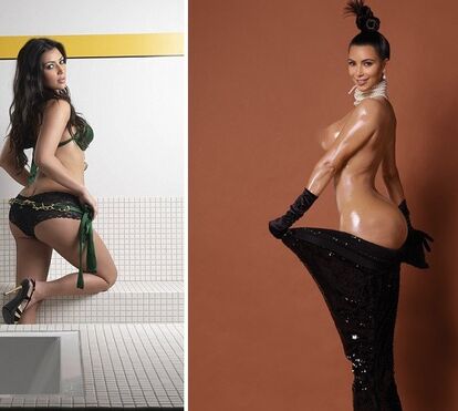 Kardashian: as fotos que provam as operações plásticas