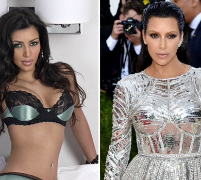 Kim Kardashian: o antes e o depois das plásticas