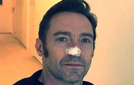 Hugh Jackman teve 6 tumores no nariz