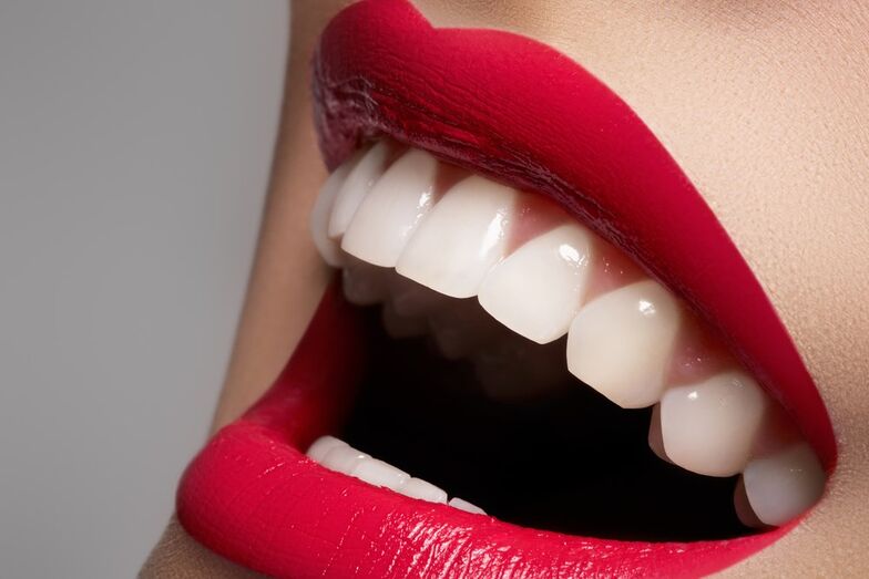 sorriso 