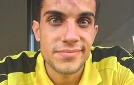 Jogador do Dortmund exibe ferimentos do atentado