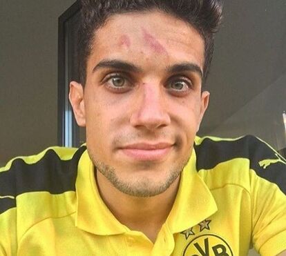 Explosão junto ao autocarro do Dortmund fere jogador