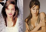 Famosos antes e depois