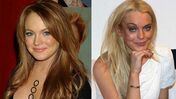 Famosos antes e depois
