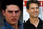 Famosos antes e depois