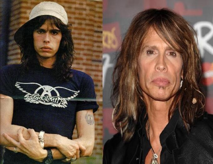 Famosos antes e depois