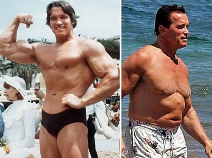 Famosos antes e depois