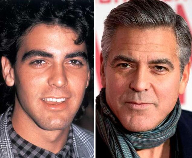 Famosos antes e depois