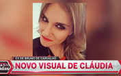 Ângelo Rodrigues já fez cirurgia plástica