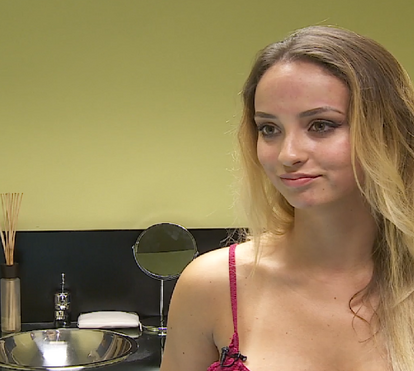 Ana Gonçalves: testemunho de uma paciente que colocou ácido hialurónico nos lábios