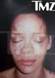 agressão de Chris Brown a Rihanna