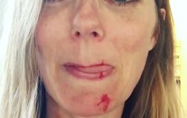 Número de óbitos por coronavírus volta a subir em Portugal