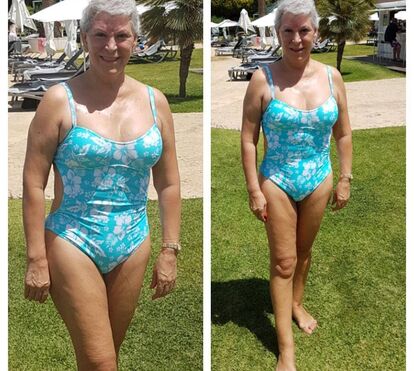 A recuperar do cancro do pâncreas, Jó Caneças mostra-se elegante de fato de banho 