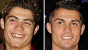 cristiano ronaldo, dentes