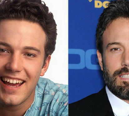 Sorriso perfeito faz a diferença: famosos foram ao dentista e a mudança é radical