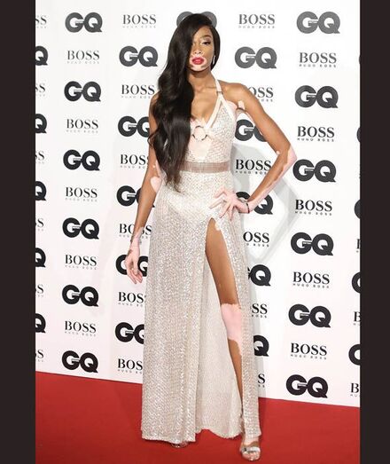 Winnie Harlow