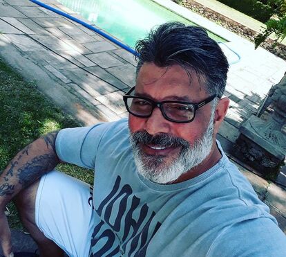 Alexandre Frota faz intervenção no pénis