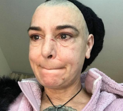 Sinead O'Connor é vítima de violência doméstica pelo próprio filho 