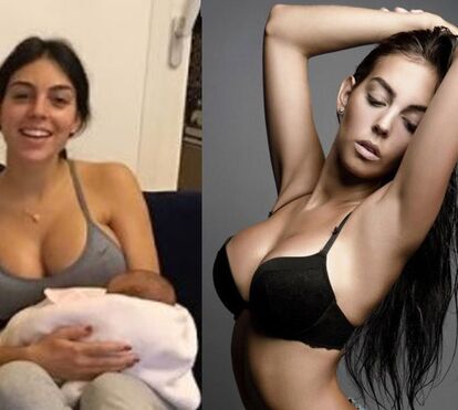 Veja como o peito de Georgina mudou