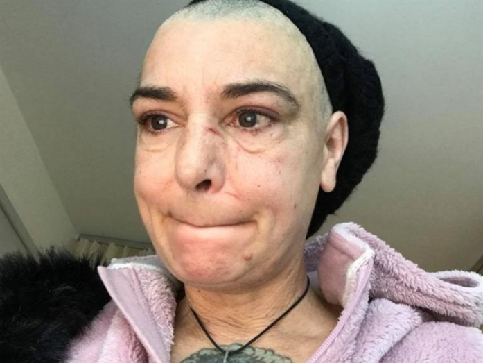 Sinéad O'Connor