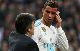 Impressionante. Cristiano Ronaldo obrigado a levar pontos após pontapé na cara