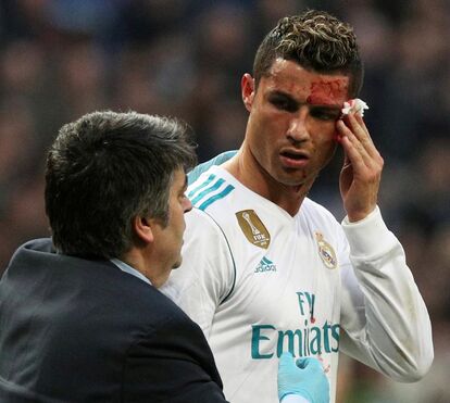 Cristiano Ronaldo abre a sobrancelha em campo e fica cheio de sangue