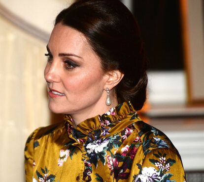 As cicatrizes de Kate Middleton e do príncipe William que estão a dar que falar