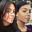 georgina, botox, plásticas
