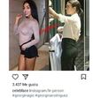 georgina, botox, plásticas