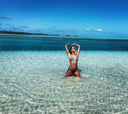 Sara Sampaio sofre acidente durante férias