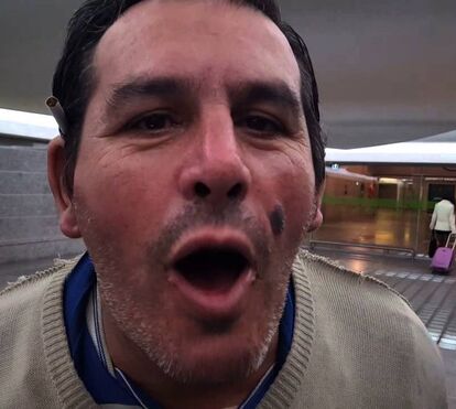 Saiba quem é o famoso 'Emplastro'