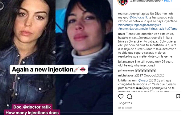 georgina, botox, plásticas