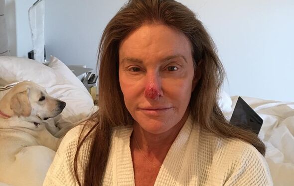 Caitly Jenner 