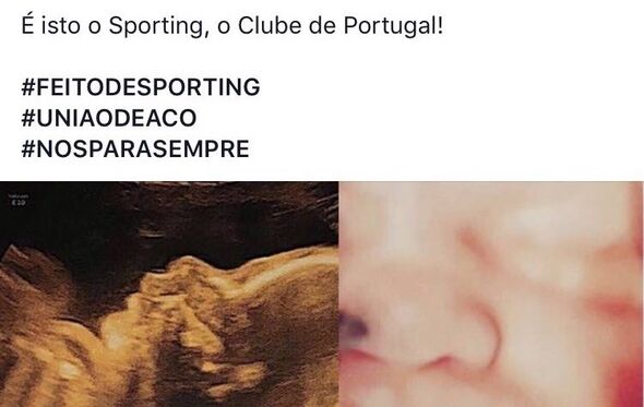 bruno de carvalho post bebé 