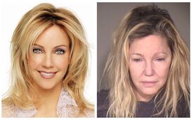 A assustadora decadência de Heather Locklear, que foi uma das atrizes mais bonitas de Hollywood