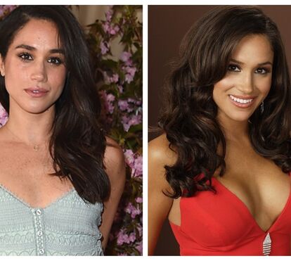 Meghan Markle já recorreu à cirurgia plástica