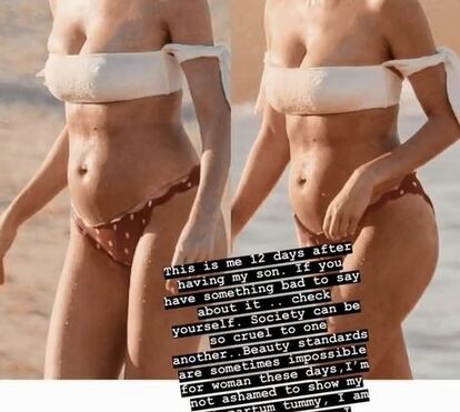 'Top model' Candice Swanepoel exibe com orgulho excesso de peso pós-parto