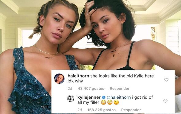 kylie jenner, kim kardashian, operação, lábios, botox