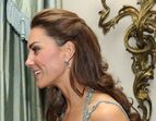 Kate Middleton, Cicatriz