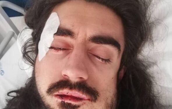 diogo fialho, ator diogo fialho, agressão diogo fialho, ator agredido, 