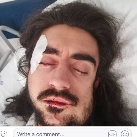 diogo fialho, ator diogo fialho, agressão diogo fialho, ator agredido, 