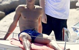 Quem é que bateu em CR7? Cristiano Ronaldo aparece com olho negro e preocupa fãs!