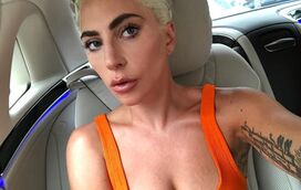 Incrível! Lady Gaga paga milhares para remover borbulhas antes da noite dos Óscares