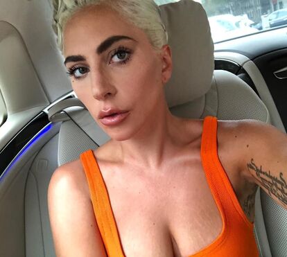 Incrível! Lady Gaga paga milhares para remover borbulhas antes da noite dos Óscares